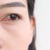 7 Pink Eye Symptoms You Shouldn't Ignore