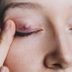 How to Get Rid of a Styeâ€”the Right Way