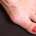 The 5 Types of Bunions: What Podiatrists Need You to Know