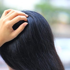 Close-up of woman hand itchy scalp fungus, Haircare concept