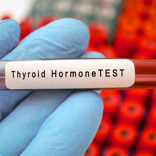 Thyroid Test